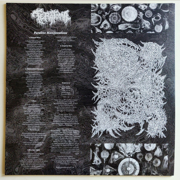 Teratoma - Purulent Manifestations LP
