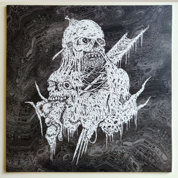 Teratoma - Purulent Manifestations LP